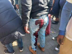 Simunye Workers Forum members shot during protest